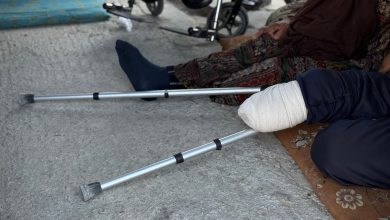 صورة بقدمٍ واحدة يواصلن رحلة التعافي جسدياً ونفسياً!