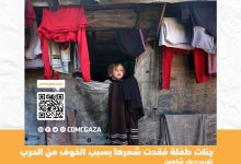 صورة “الأطفال يخافون منى”.. جنات طفلة فقدت شعرها بسبب الخوف من الحرب